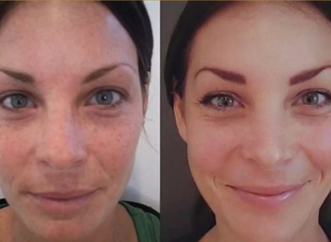 Up to 60% Off on Exfoliating Facial at Spa soleil medical spa - Primary Image