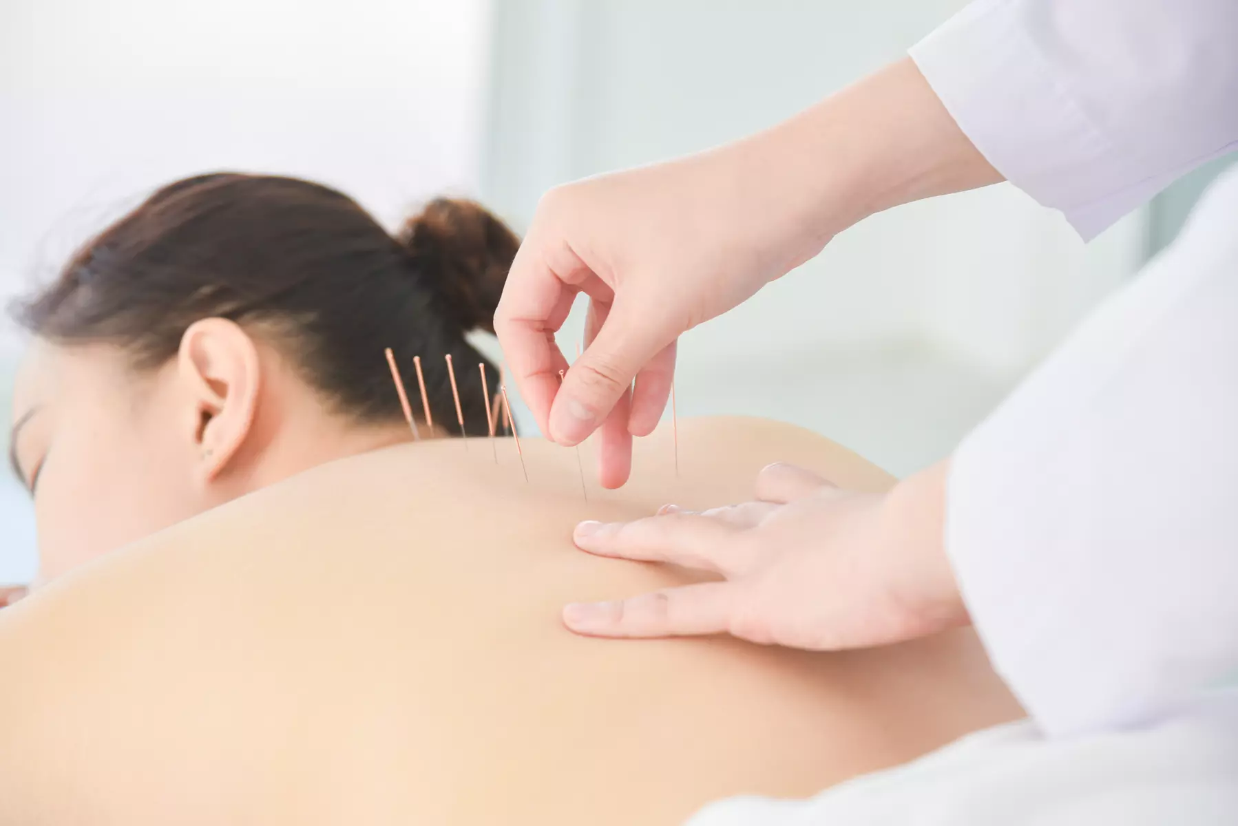 Up to 40% on Acupuncture at VUIM clinic and whole health