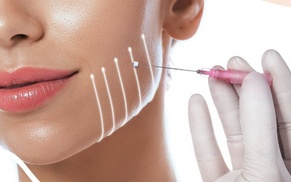 Up to 59% Off on PDO Thread Lift at Be Rejuved Wellness Studio