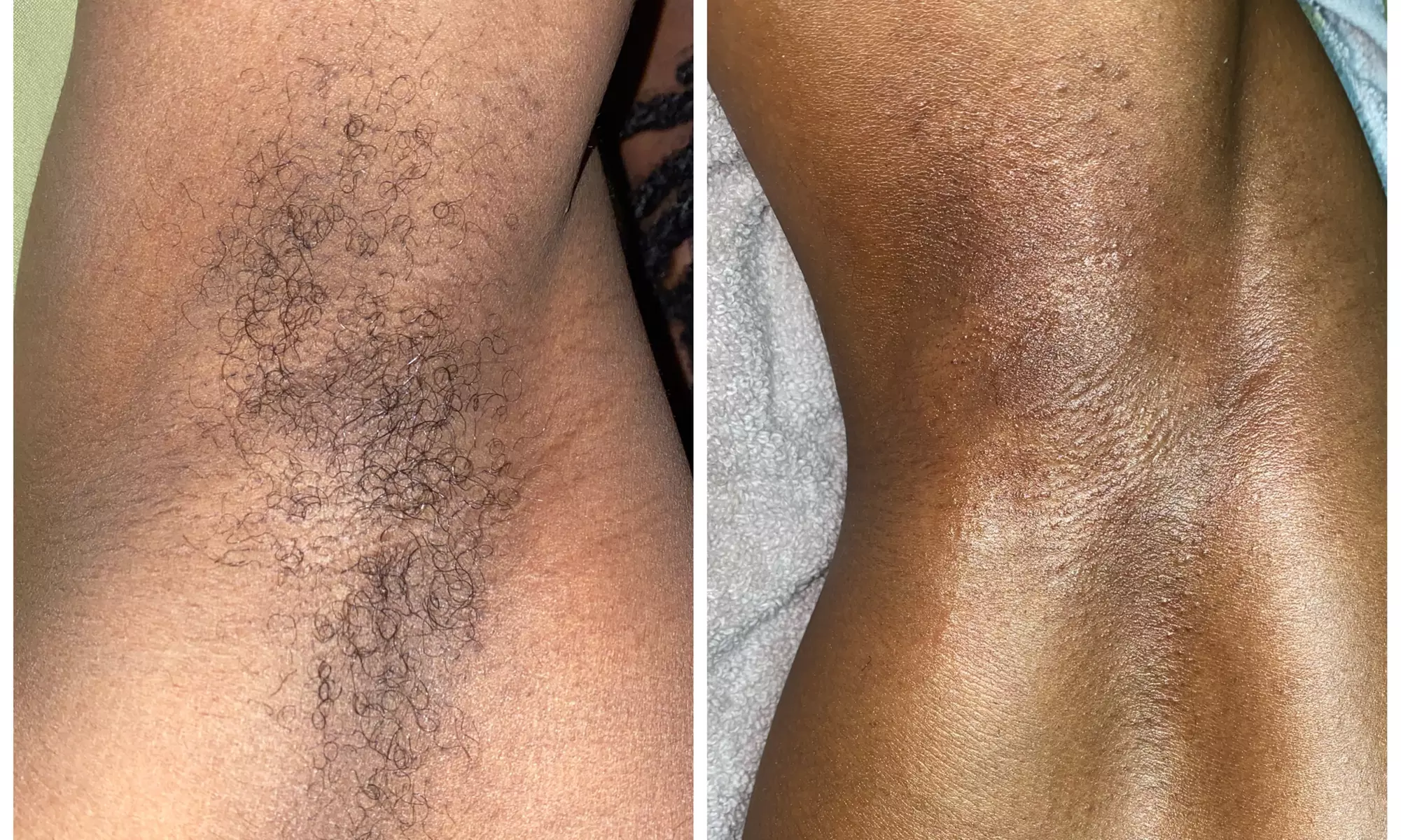 Enjoy Ooou Lala Allure's Brazilian or Bikini Waxing Sessions, Dynamic Duo, with up to 50% off for silky smooth results - Primary Image