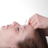 Image 1: Get Acupuncture Facial Rejuvenation