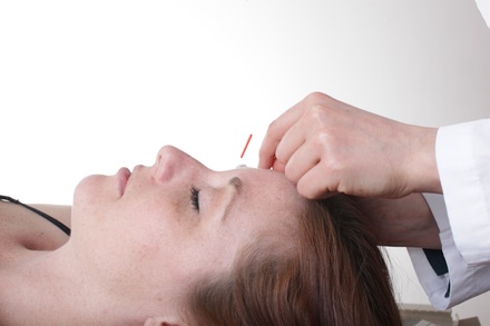 Acupuncture Facial Rejuvenation - Awakened Alignment Acupuncture PC