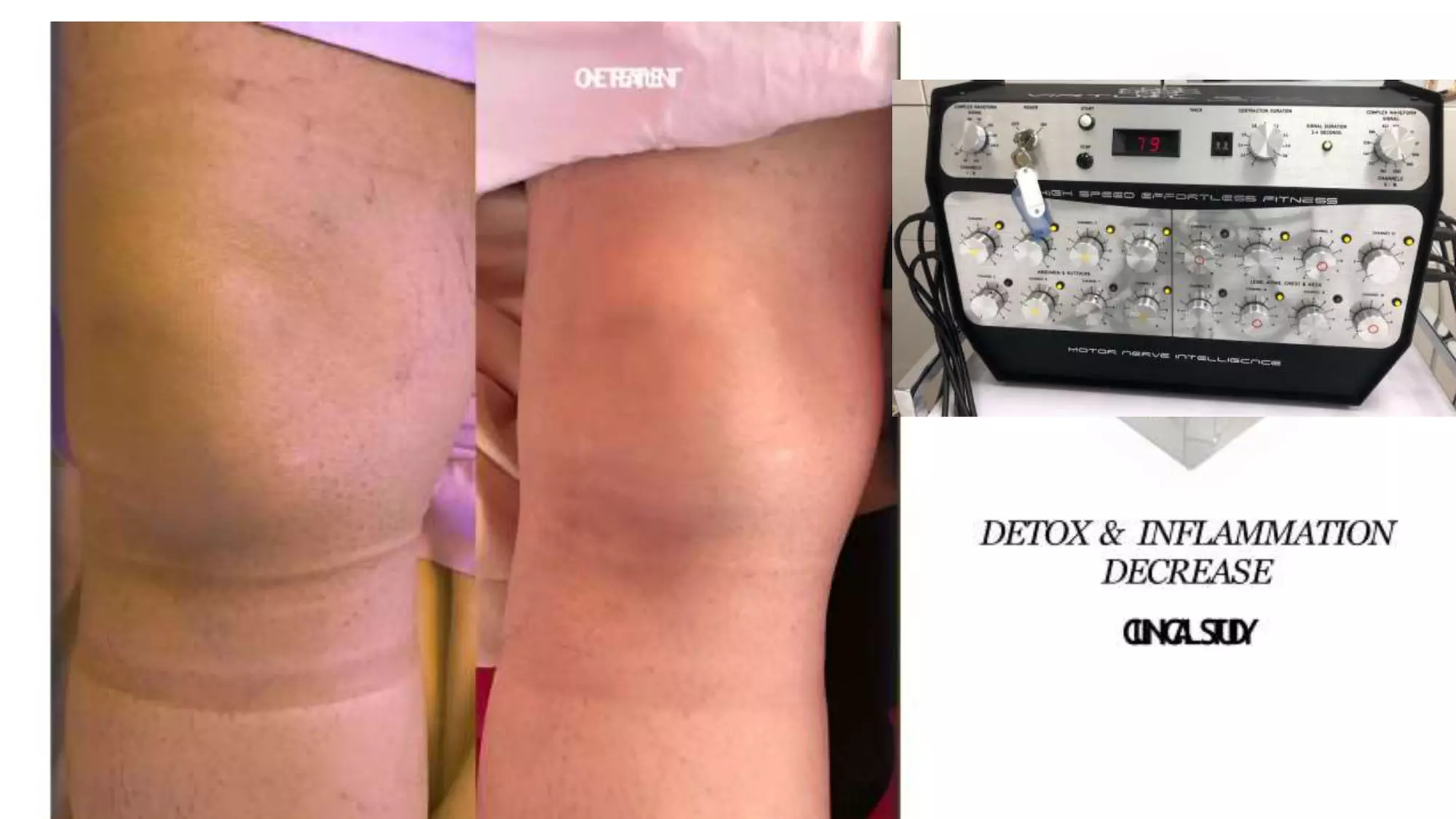 Transform with Detoxifying and Lymphatic Drainage