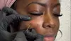 Under Eye Restoration Session with PRP Treatment at SoFlo Medical Center (Up to 37% Off)