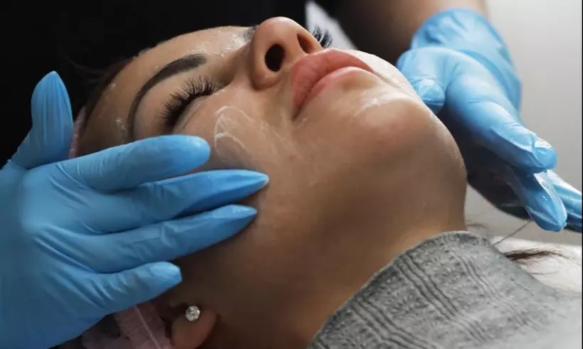 Up to 50% Off on Microdermabrasion at Istanbul Hair Salon - Primary Image