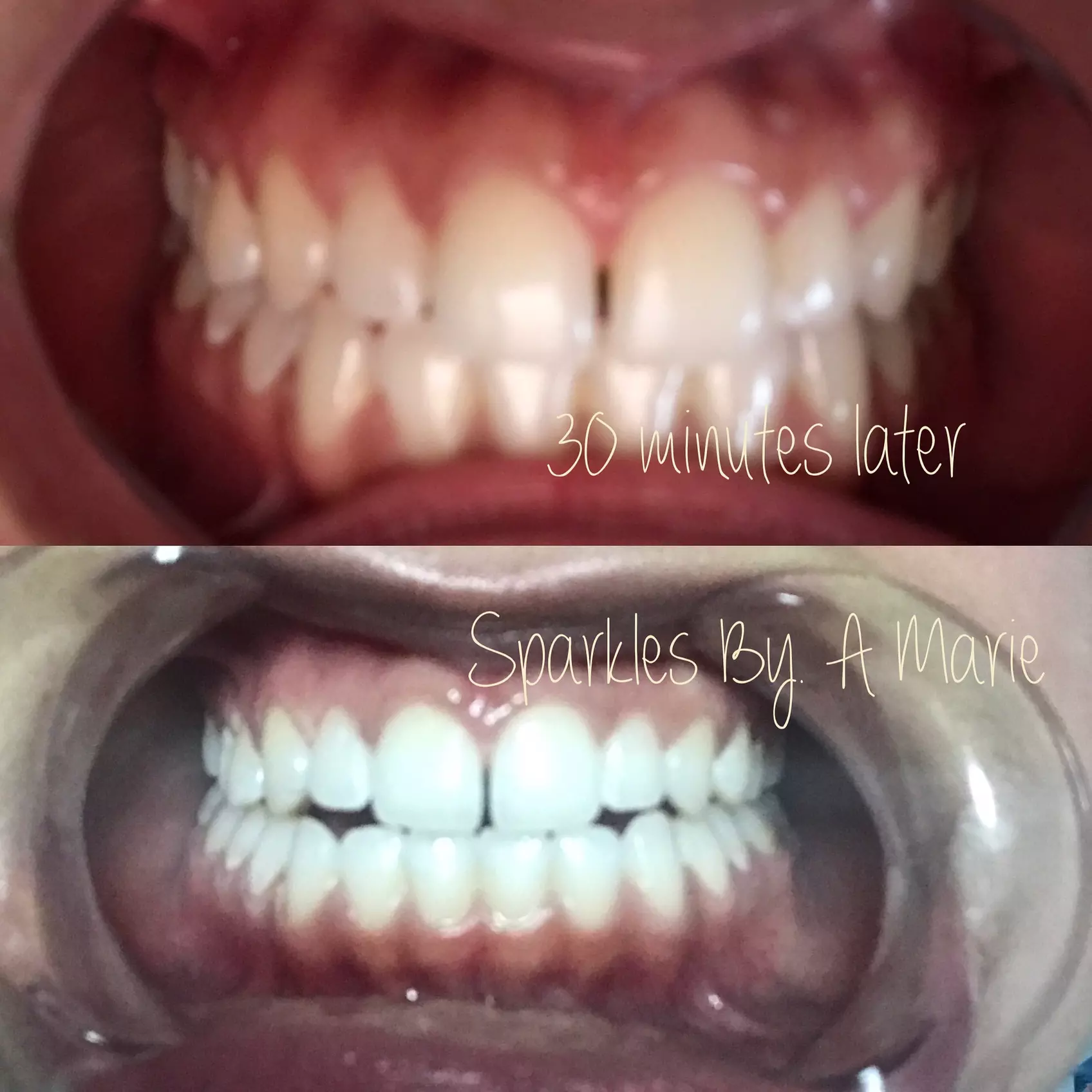 $400 Worth of Services - Second Medium