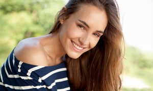 Hasta 76% off en 1, 2 o 3 sesiones de rejuvenecimiento facial