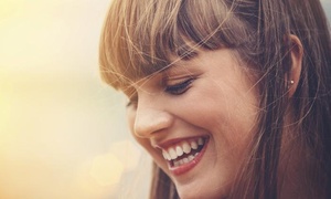 Hasta 91% off en diseño de sonrisa y/o blanqueamiento led