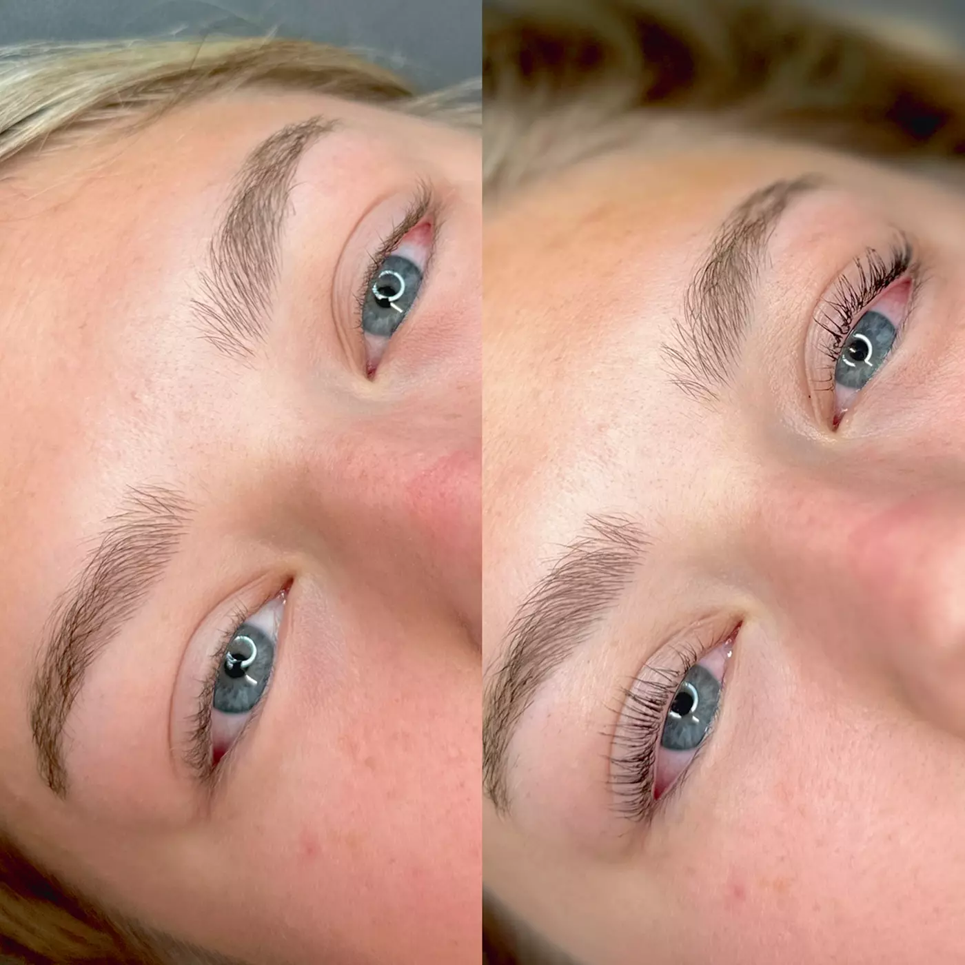 $130 For 20 Units Of Botox Or Jeuveau w/ Consultation (Reg. $260) - Primary Image