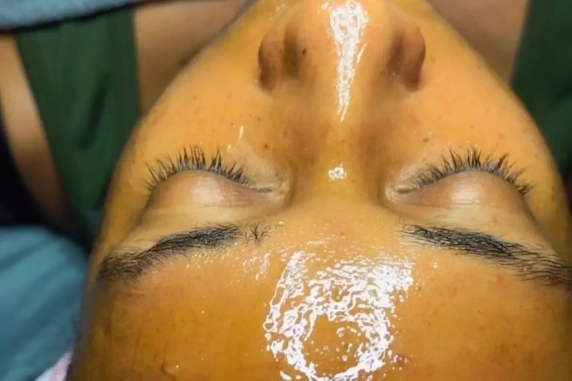 $50 For $100 Towards Facial - Primary Image