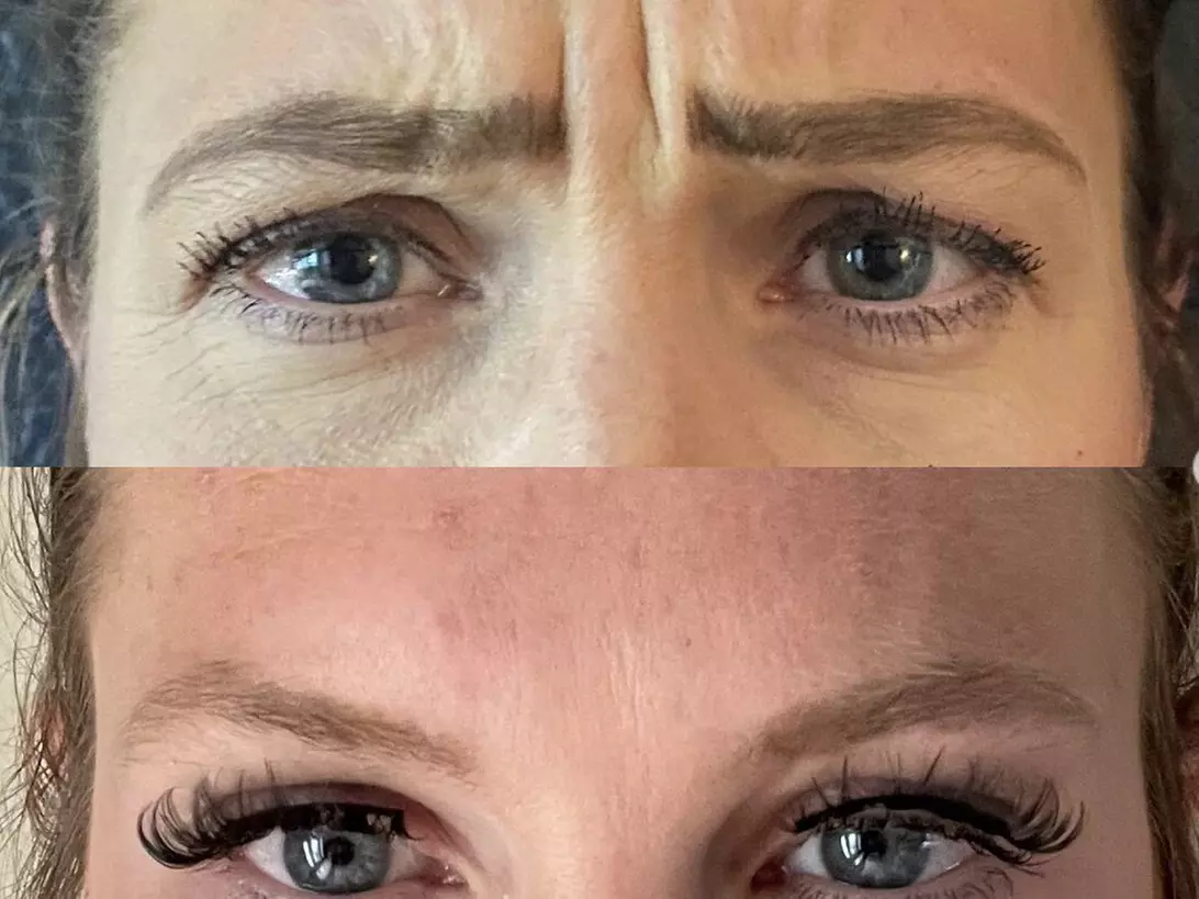 $50 For $100 Toward Any Aesthetic Or Wellness Service