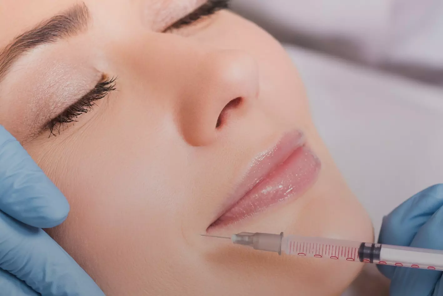 $449 For 1 Juvederm Ultra Injectable Filler W/ Facial Consultation ...