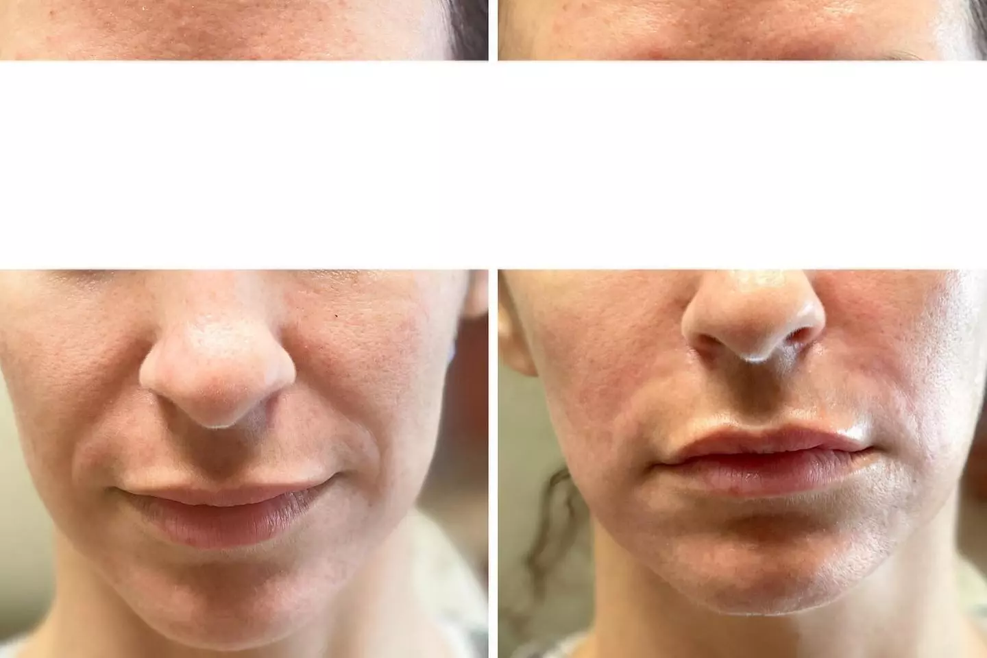 $50 for $100 Worth Of Any Spa Service