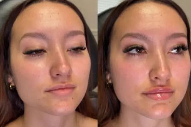 $40 For $80 Towards Any Service