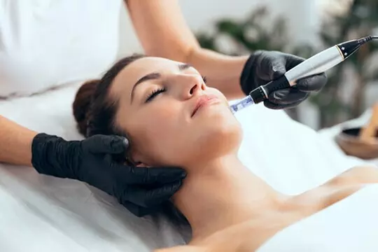 $162.50 For A Microneedling Session ($325)
