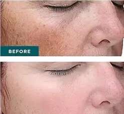 $75 For A Customized Facial (Reg. $150)