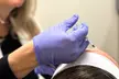 $299 For 50 Units Of Botox With Facial Consultation - NEW CLIENTS ONLY (Reg. $800) - Second Medium