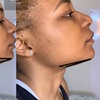Image 2: $50 for $100 Toward Body Sculpting & Contouring Treatments