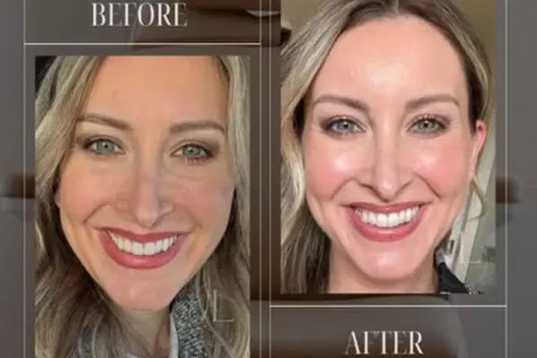 $50 For $100 Toward Any Aesthetic Or Wellness Service