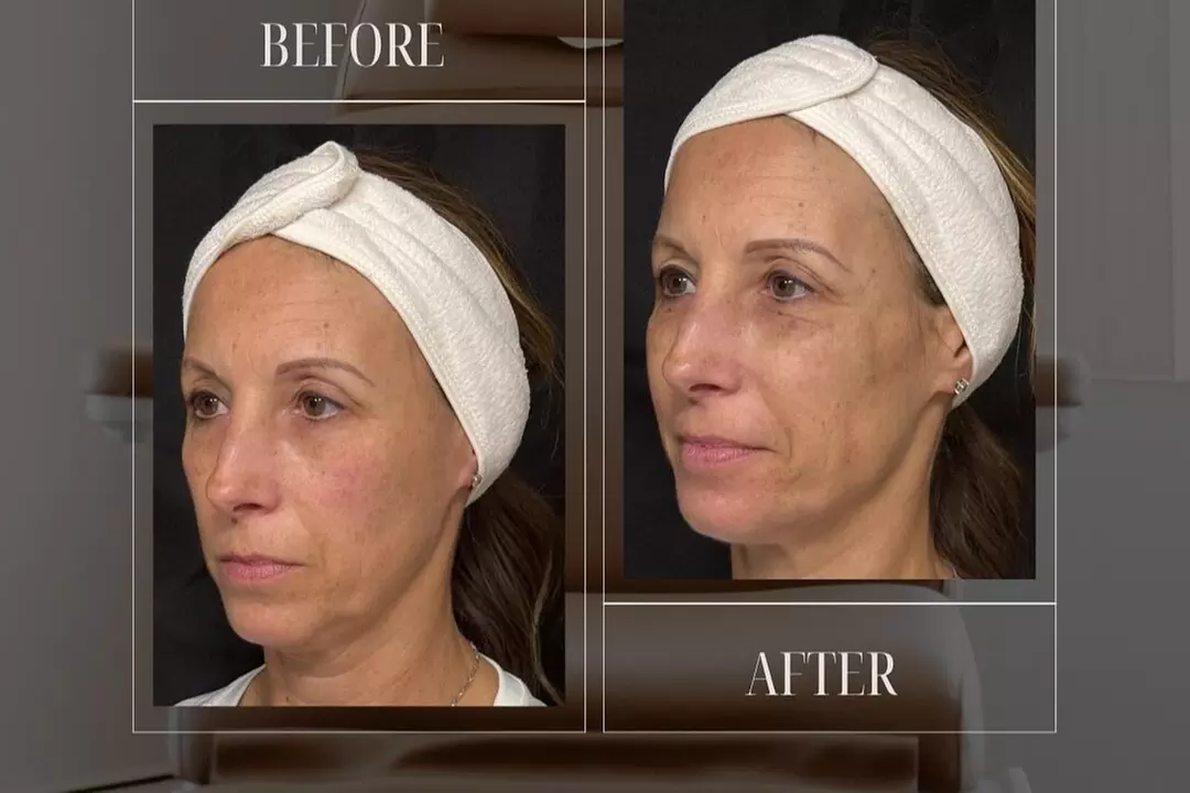 $50 For $100 Toward Any Aesthetic Or Wellness Service