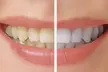$100 For $200 Toward Esthetic Services - Second Medium