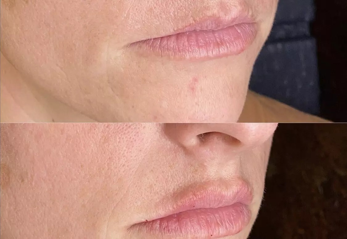 $50 For $100 Toward Any Aesthetic Or Wellness Service