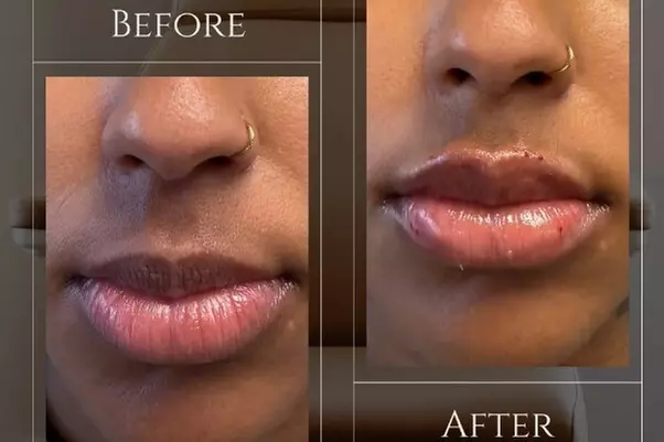 $50 For $100 Toward Any Aesthetic Or Wellness Service