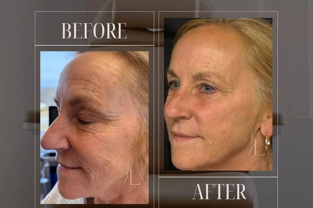 $50 For $100 Toward Any Aesthetic Or Wellness Service