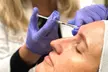 $299 For 50 Units Of Botox With Facial Consultation - NEW CLIENTS ONLY (Reg. $800) - Second Medium