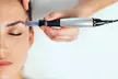 $162.50 For A Microneedling Session ($325) - Second Medium