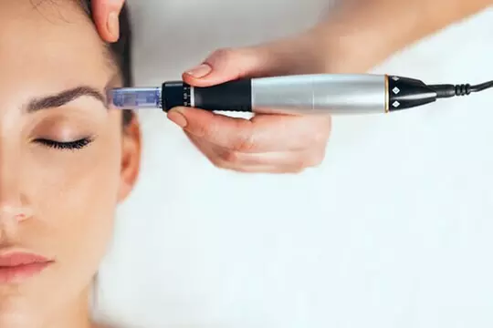 $162.50 For A Microneedling Session ($325)