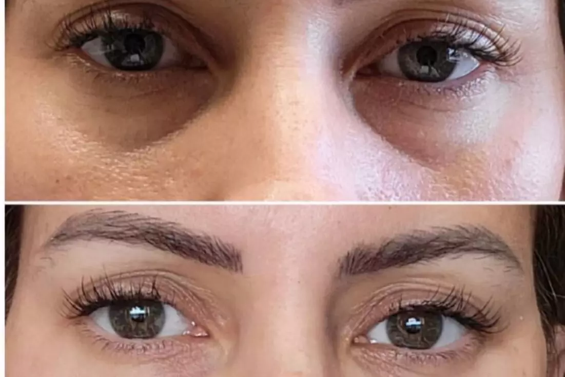 $50 for $100 Worth Of Any Spa Service