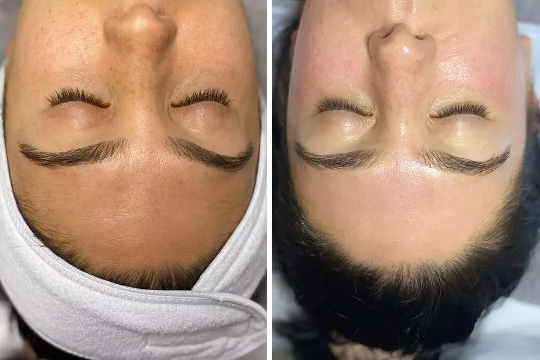 $50 For $100 Toward Any Spa Service