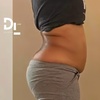 Image 4: $50 for $100 Toward Body Sculpting & Contouring Treatments