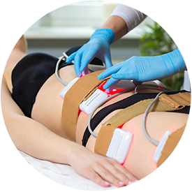laser lipo