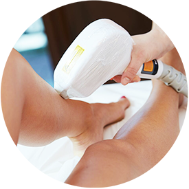 laser hair removal