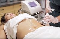Woman getting ultrasonic cavitation