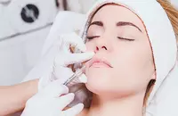 Juvéderm FAQs: What It Does, Cost & More