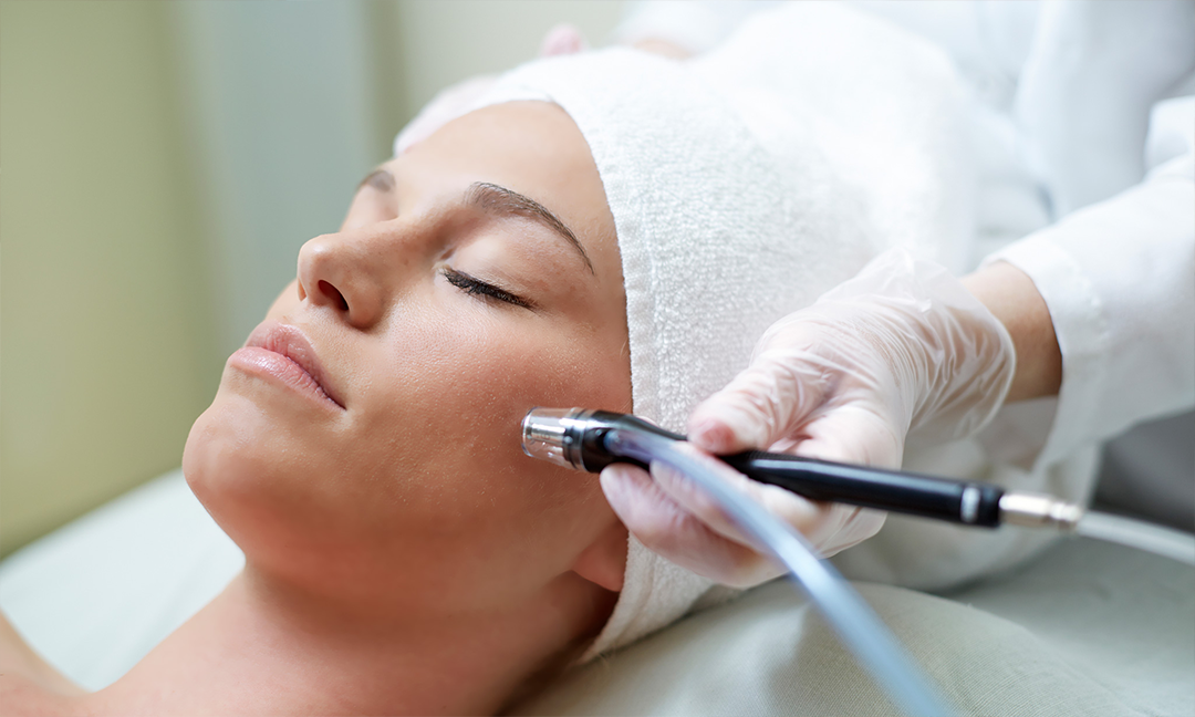 microdermabrasion
