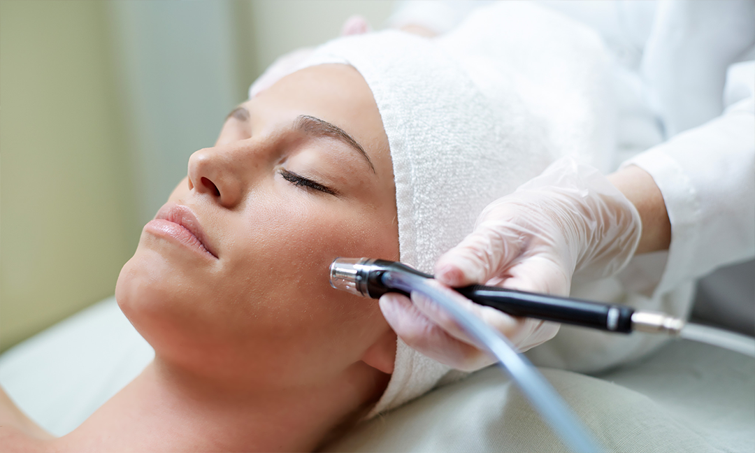 What Is Microdermabrasion and Do You Need It?