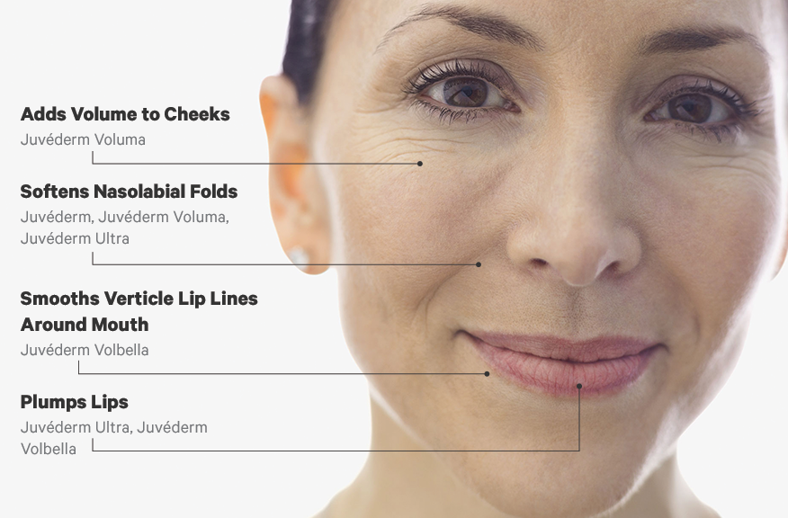 juvederm #botox #nosurgery ...