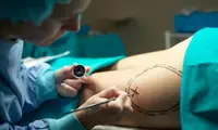 Doctor marking a patient for liposuction