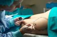 plastic surgery history infograph