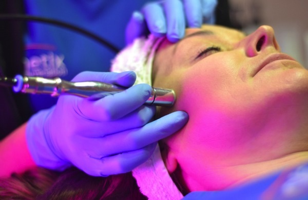 What is Microdermabrasion? - Everything You Need To Know From an Expert