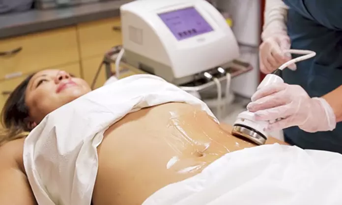 Woman getting ultrasonic cavitation