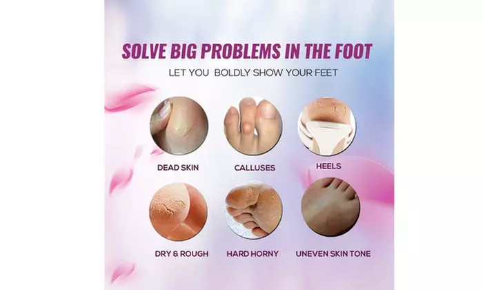 Leah Naturals Exfoliating Peel off Foot Mask Remove Callus Dead Skin - Second Medium