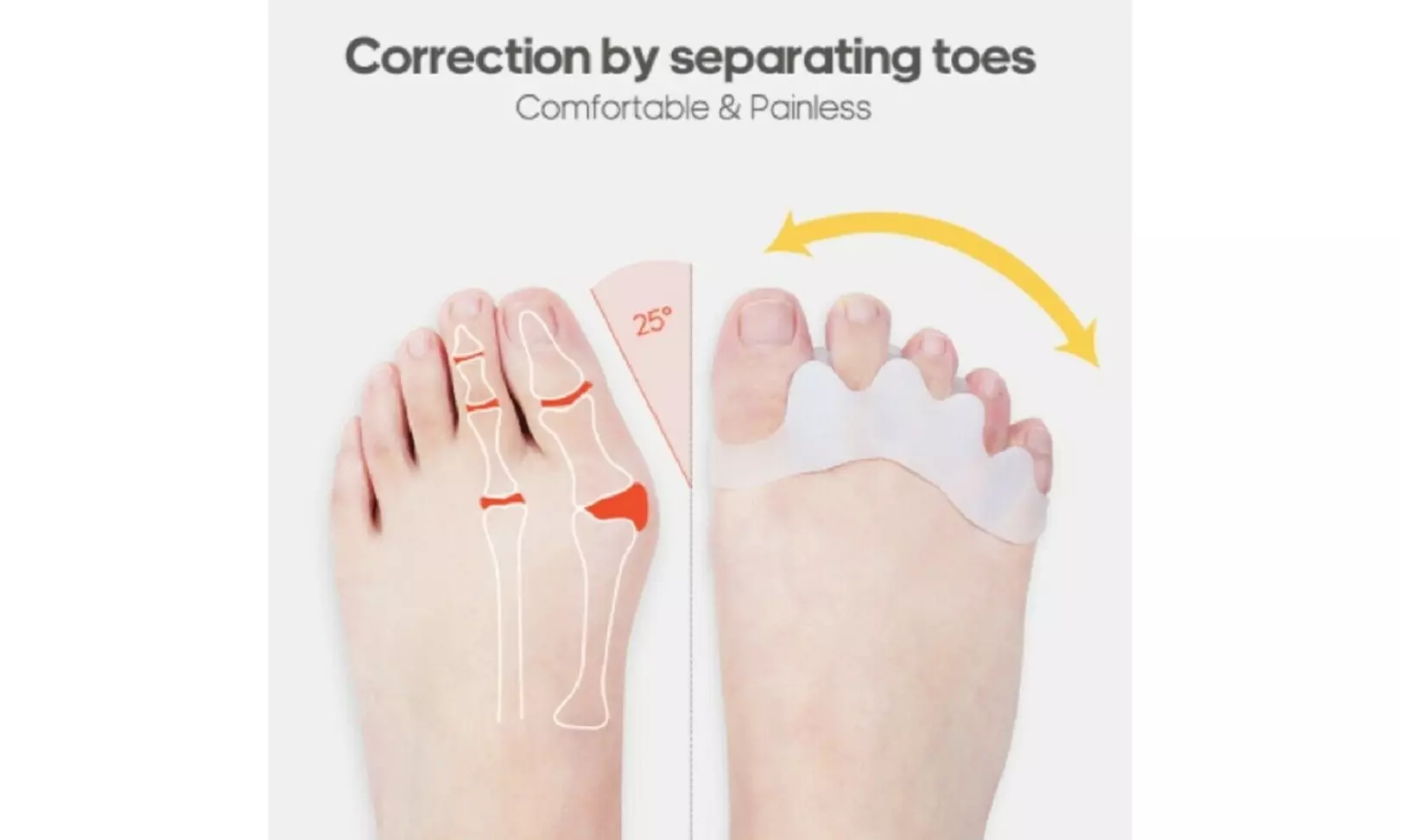 1Pair Silicone Gel Bunion Toe Corrector Orthotics Straightener Separator