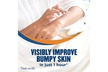 Gold Bond Ultimate Rough & Bumpy Daily Skin Therapy, 8 Ounce, Helps Exfoliate - Second Medium