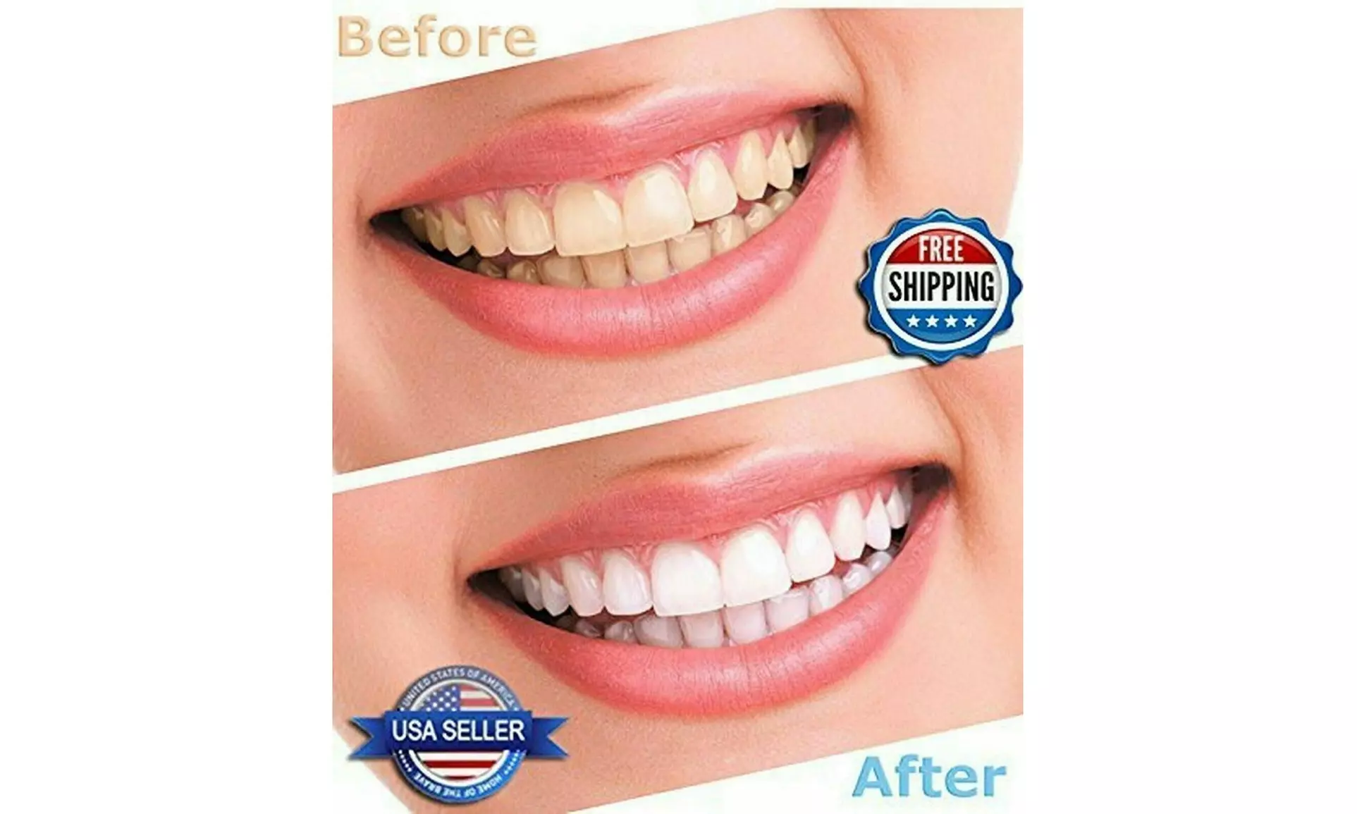 Teeth Whitening Thermo Trays Moldable Mouth 10/20/30 pieces - Primary Image