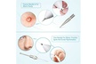 Spot Removal Pen Plasma Dot Mole Removal Sweep Spot Pen Set - Second Medium